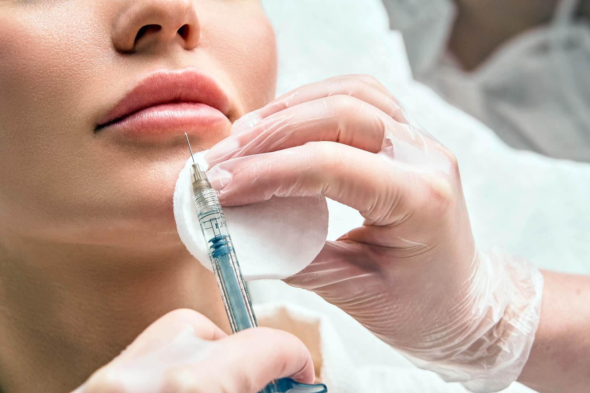 lip-filler-injections