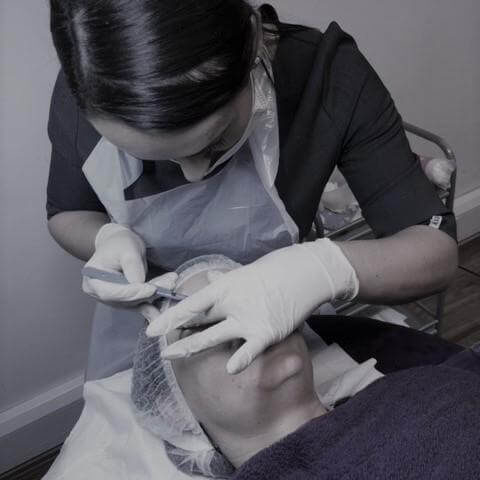 Dermaplaning_louise Dermaplaning_louise