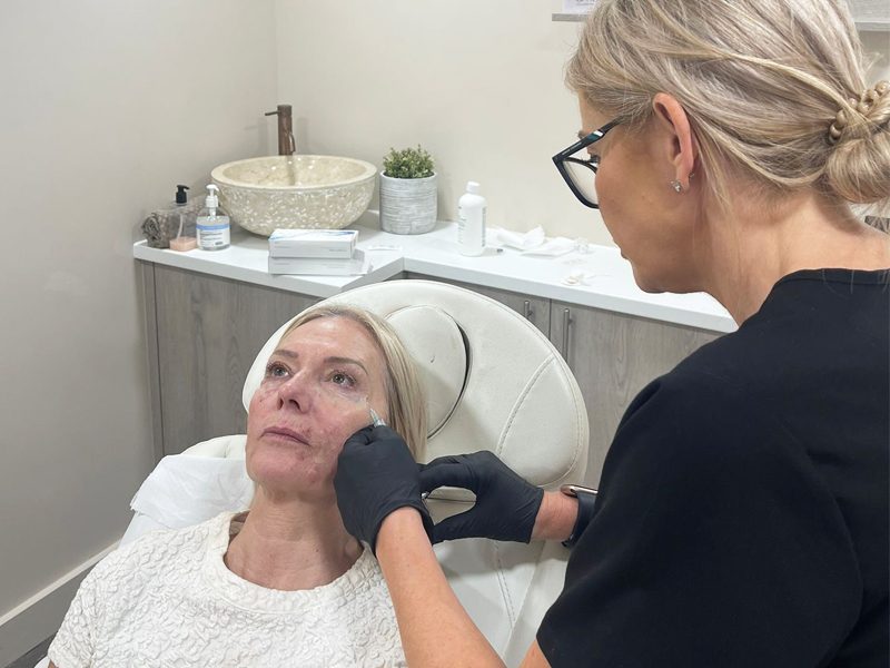 Injectables